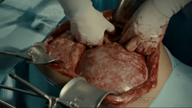 VampireDiariesWorld-dot-org_SavingHope2x10-0563.jpg