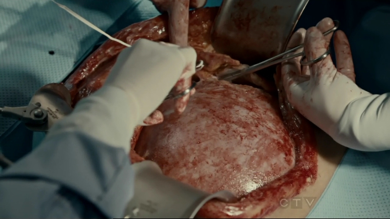 VampireDiariesWorld-dot-org_SavingHope2x10-0580.jpg