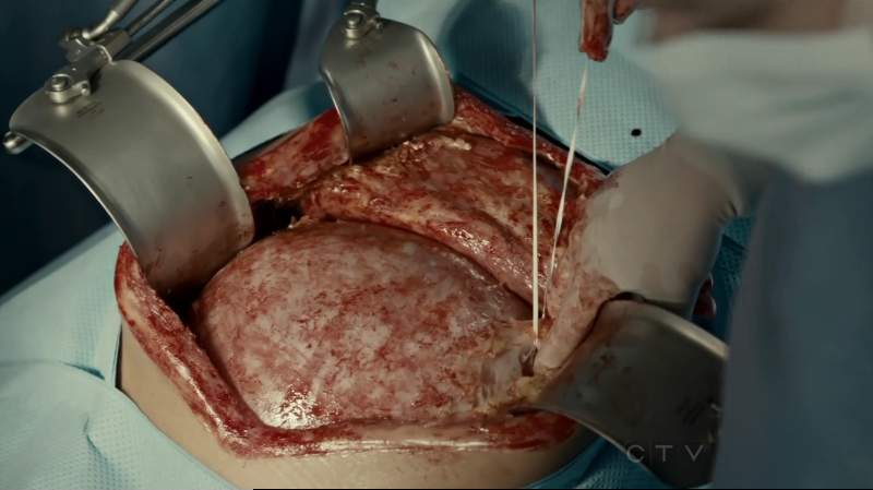 VampireDiariesWorld-dot-org_SavingHope2x10-0587.jpg