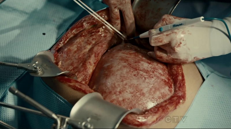 VampireDiariesWorld-dot-org_SavingHope2x10-0598.jpg