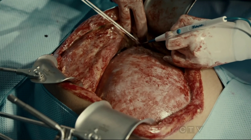 VampireDiariesWorld-dot-org_SavingHope2x10-0599.jpg