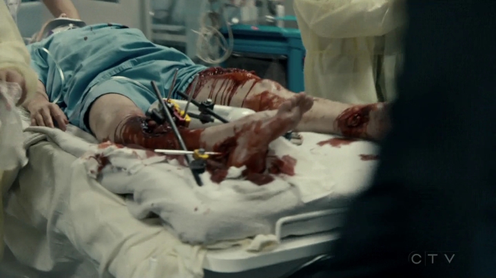 VampireDiariesWorld-dot-org_SavingHope3x01-0478.jpg