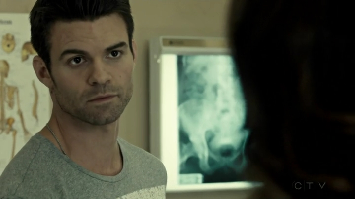 VampireDiariesWorld_dot_nl-SavingHope3x10-827.jpg