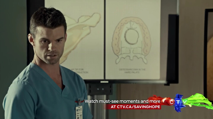 VampireDiariesWorld_dot_nl-SavingHope3x13-1297.jpg