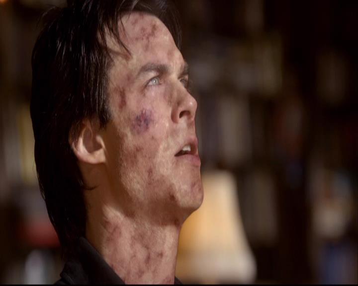 VampireDiariesWorld-dot-org_2x22AsILayDying0156.jpg